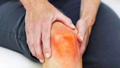 Fakta Medis Seputar Asam Urat: Memahami Kondisi, Penyebab, dan Pengelolaannya